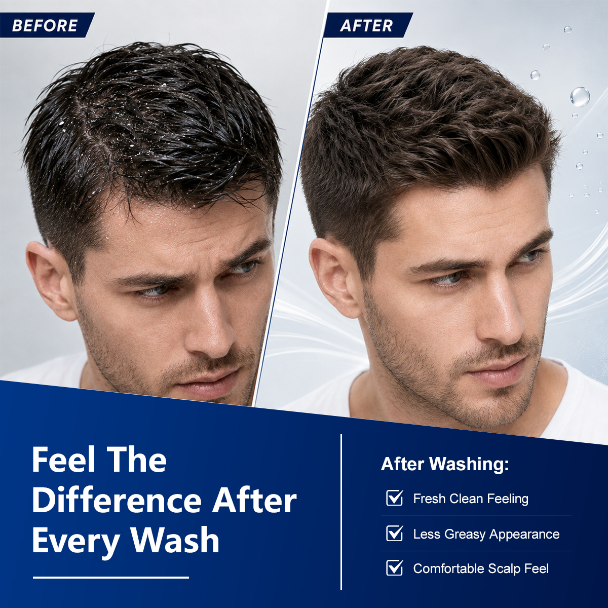 Private Label Dandruff Scalp Treatment Men Shampoo for Anti-Itch Organic Salicylic Acid Anti Dandruff Shampoo White Label