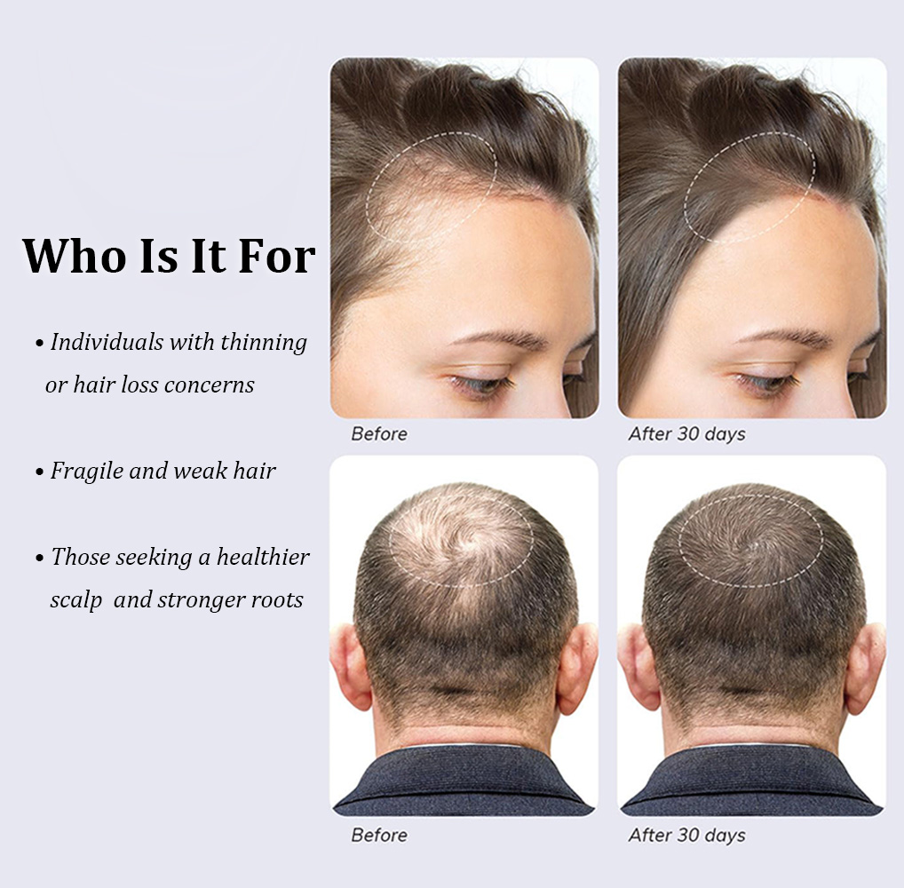 OEM Herbal Nourishing Scalp Strengthening Shampoo Anti-Hair Loss Volumizing for Thin &amp; Oily Hair Damaged Scalp ODM Private Label