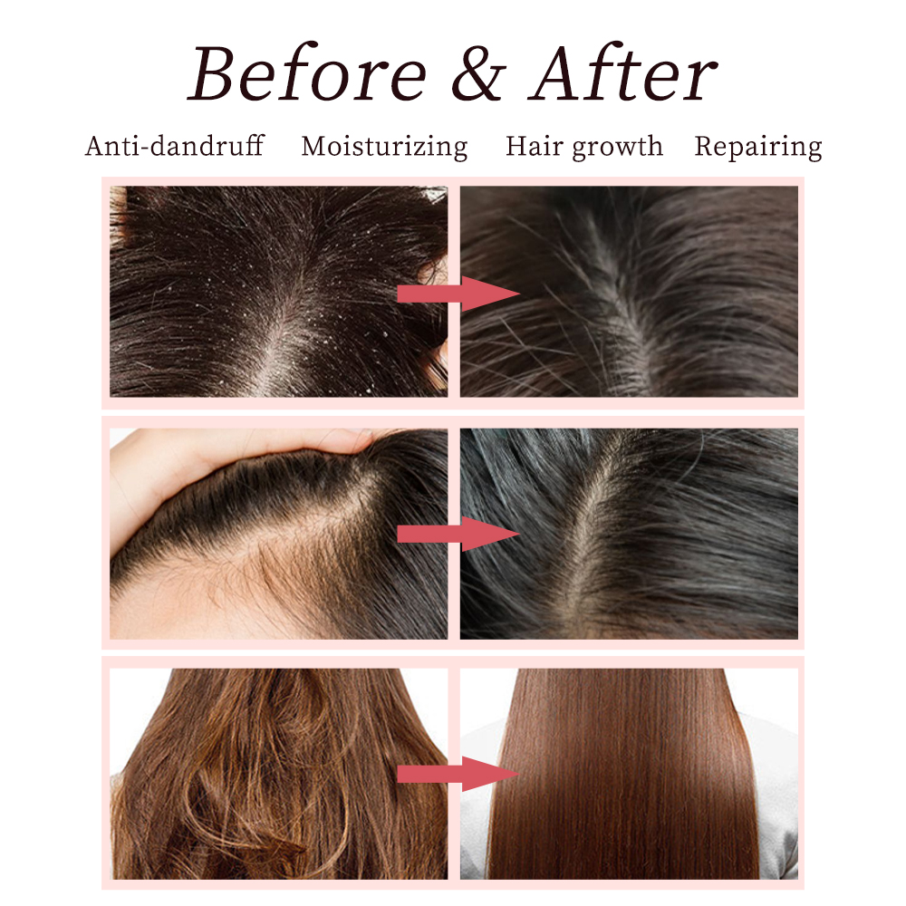 Wholesale Organic Natural Moisturizing Fluffy Shampoo Conditioner Private Label Sulfate Free Argan Oil Coconut Tea Tree Shampoo